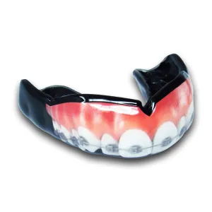 <span>Teeth w/ Braces</span> Mouthguard